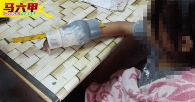 女童在度假村游泳  右手遭吸入排水管