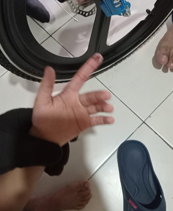 男童左手食指受困脚车链后受轻伤。（图由甲州消拯局提供）