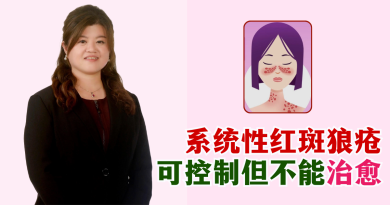 系统性红斑狼疮难缠 无妥善治疗可致命