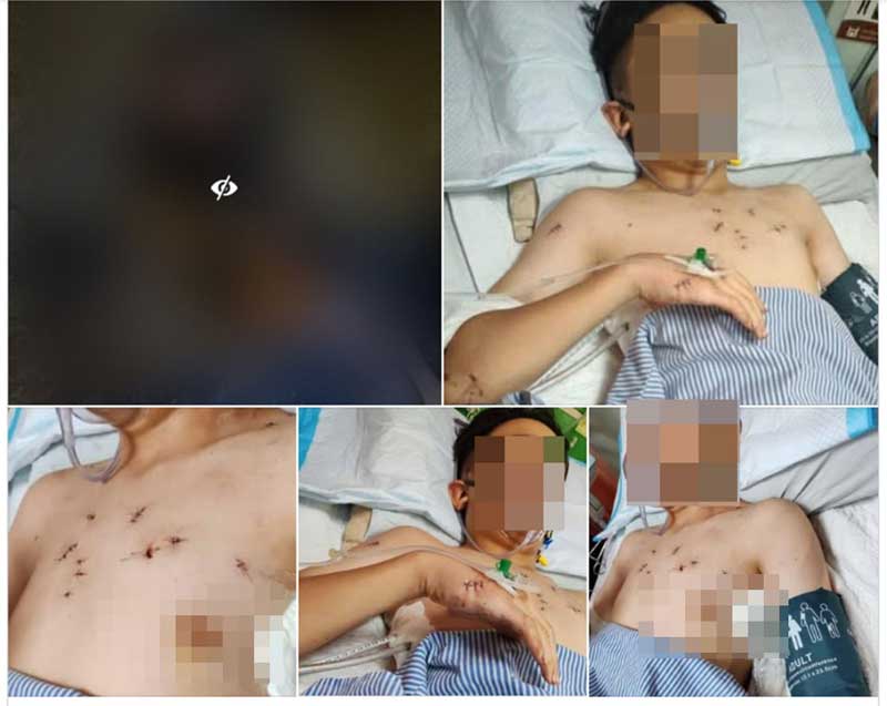 网络流传伤者受伤接受治疗的照片。（图取自网络）